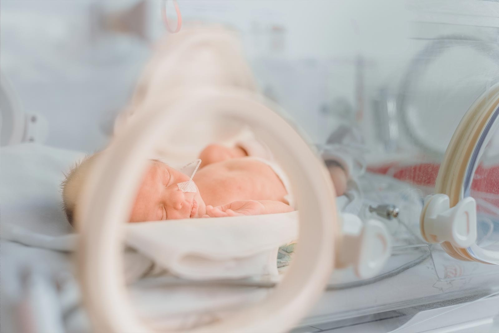 Parto prematuro, una neonata in un’incubatrice