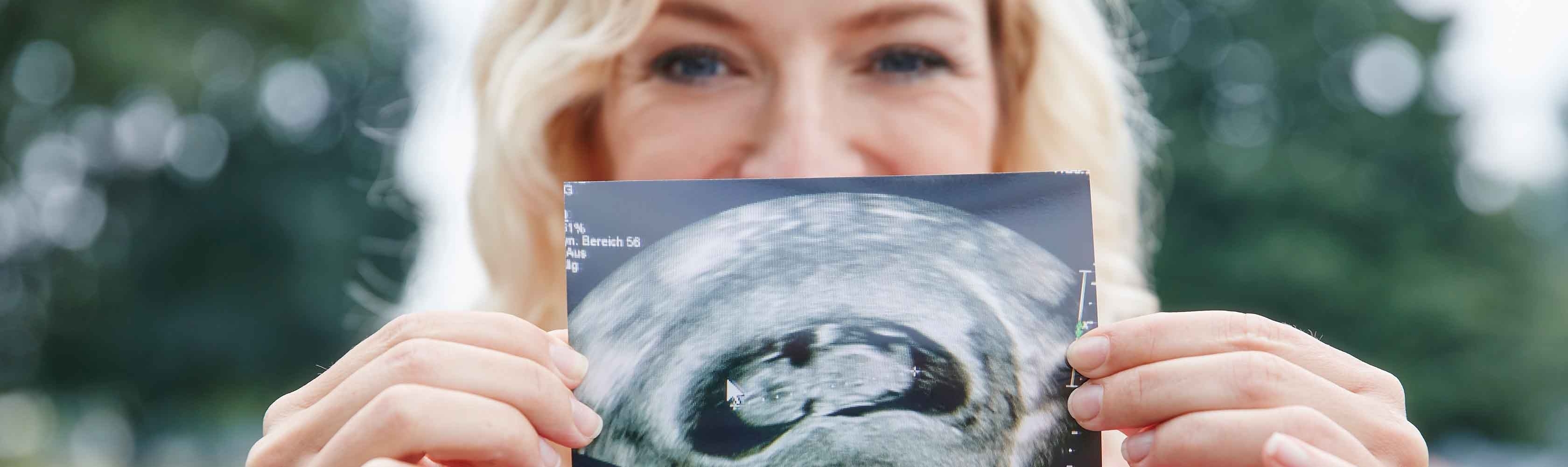 Schwangerschaft – Frau zeigt Ultraschallbild in die Kamera